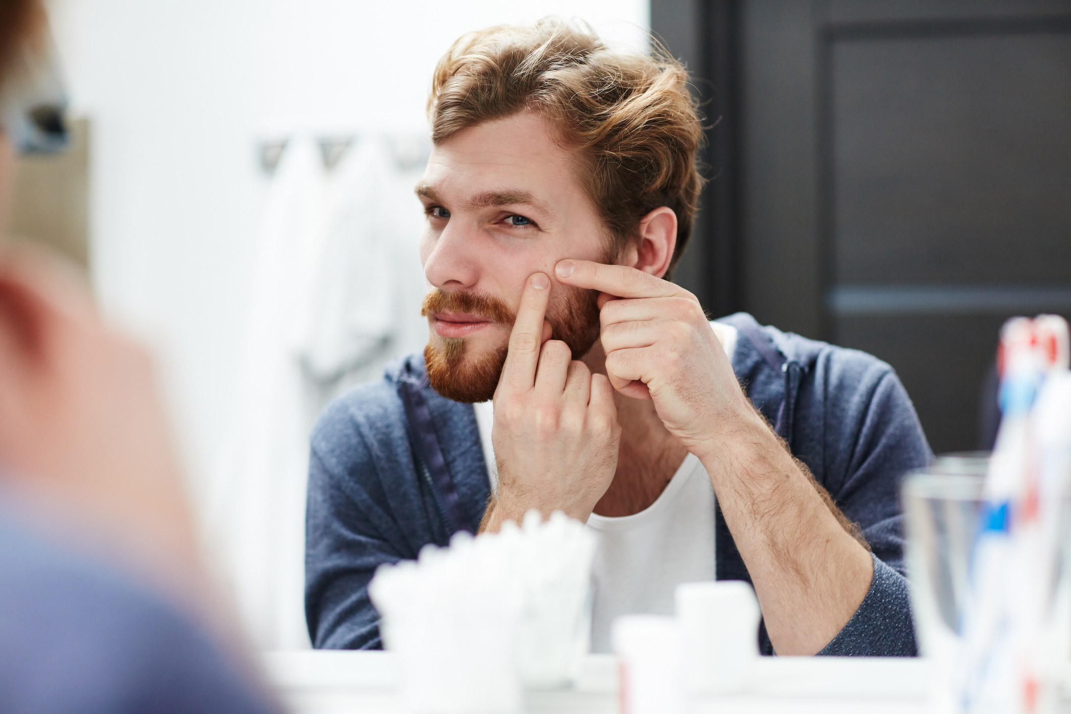 Dez mitos e verdades sobre a acne. Tire suas dúvidas!